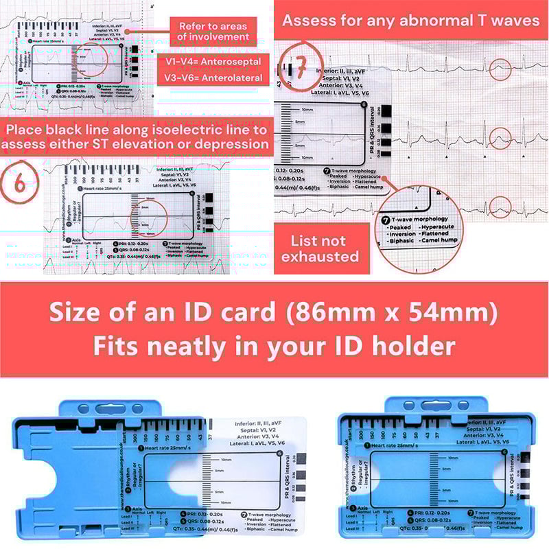 ECG 7 Step Ruler